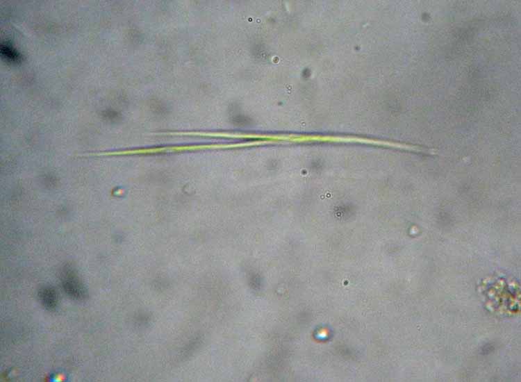 Canale Bruciati, SIC Valli di Novellara RE: le alghe